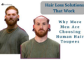 Hair Loss Solutions That Work: Why More Men Are Choosing Human Hair Toupees
