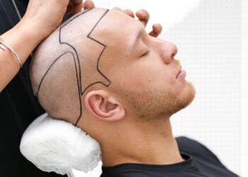 Hair Transplant Cost Turkey , Pay for Outcomes, Not Hype