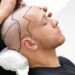 Hair Transplant Cost Turkey , Pay for Outcomes, Not Hype