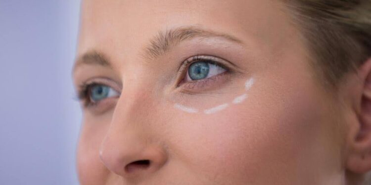 Treating Tired Eyes: From Dark Circles to Droopy Lids—What Works?